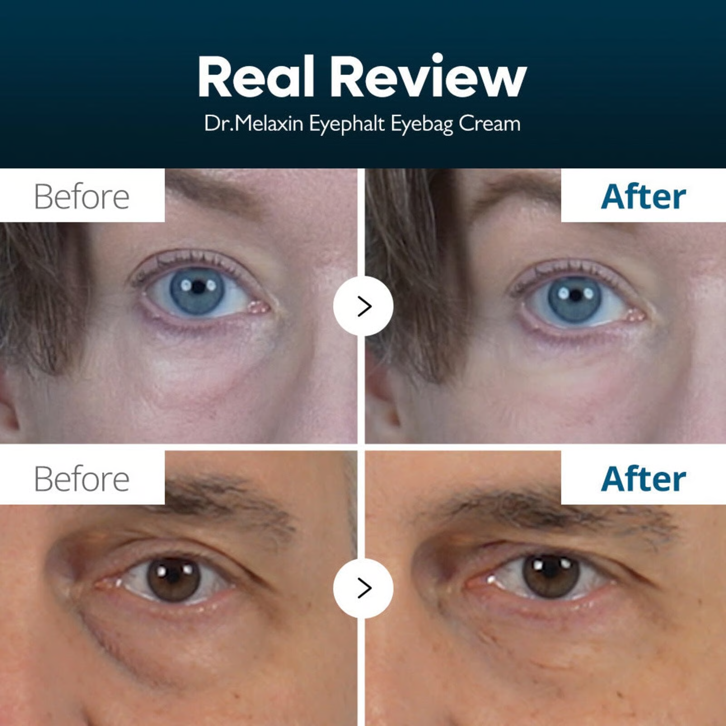 Dr. Melaxin Eyephalt Eye Cream for Eye Bags