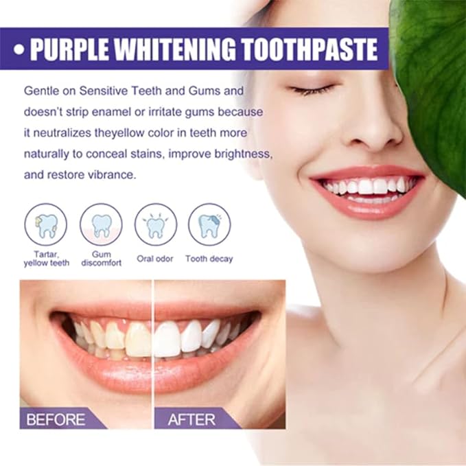 Purple Whitening Toothpaste – Brighten Your Smile Every Day 💜🦷