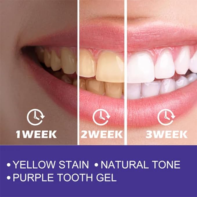 Purple Whitening Toothpaste – Brighten Your Smile Every Day 💜🦷